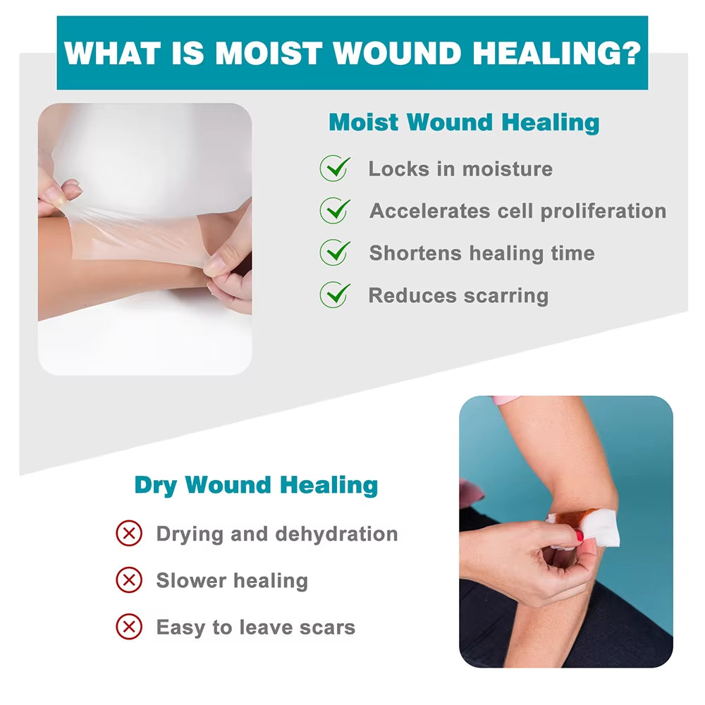 Hydrocolloid Roll Self-Adhesive Hydrocolloid Patch Bandage for Wound Care Bed Sore Bandages Hydrocolloid Gel Waterproof Patches